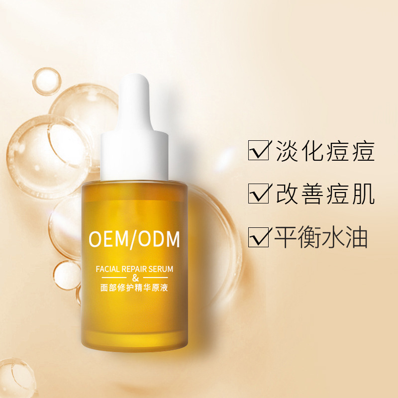 常州市_祛痘精华原液OEM