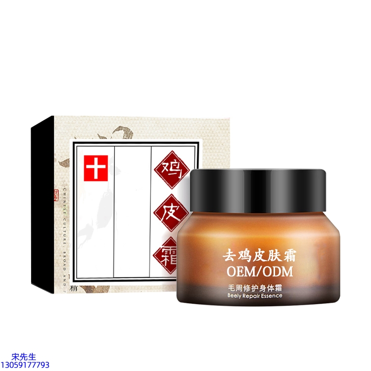 常州市_去鸡皮肤毛刺毛角周滋润修复保湿身体霜
